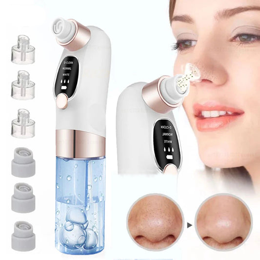 Vacuum Blackhead Remover - A minha loja